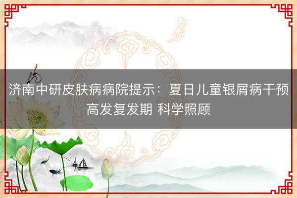 济南中研皮肤病病院提示：夏日儿童银屑病干预高发复发期 科学照顾